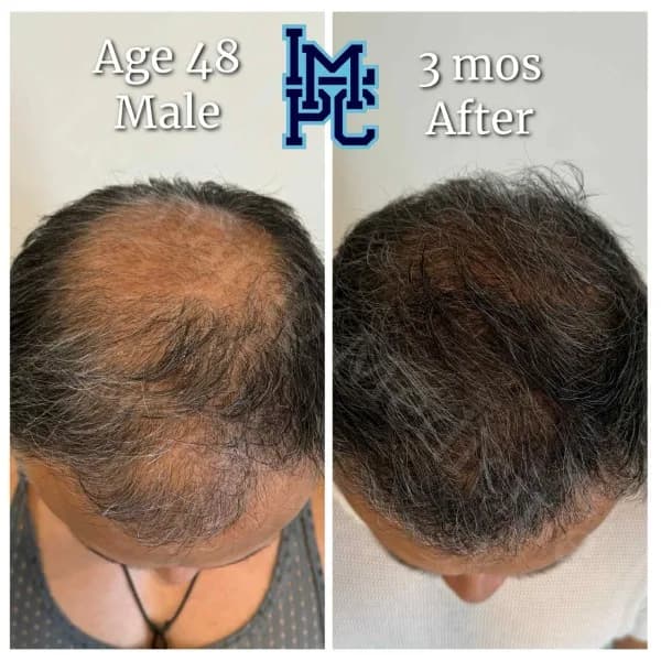 Topical Hair Treatment case 1