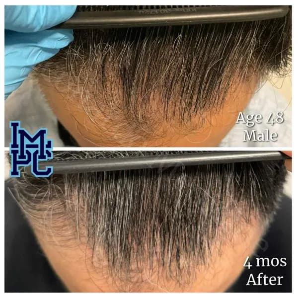 Topical Hair Treatment case 12
