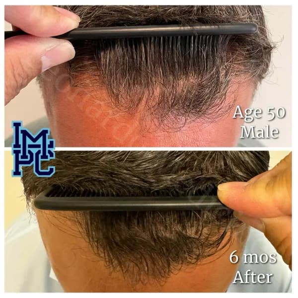 Topical Hair Treatment case 4