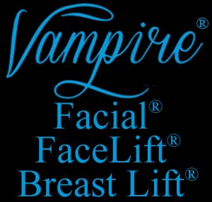 Vampire® Procedure